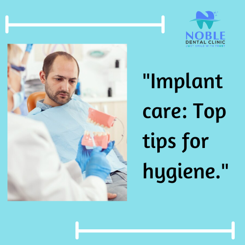 Are you enjoying the confidence of your dental implants? Keeping your oral health in top-notch co… post image