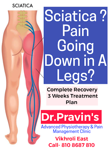 Best Non Surgical Treatment for Sciatica pain. post image