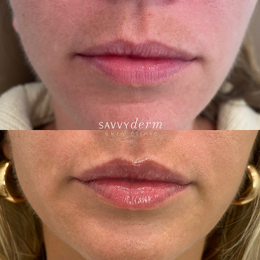 SavvyDerm Skin Clinic