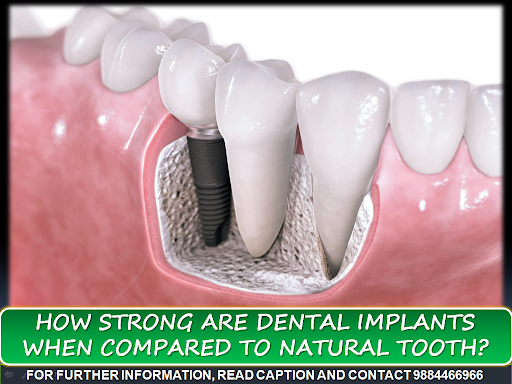If we compare the dental implant with healthy natural teeth than the answer is of course NO, beca…
