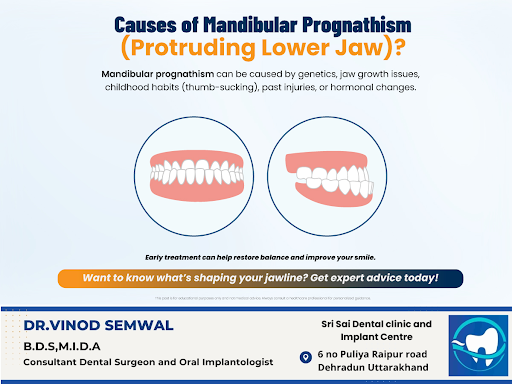 While family history plays a role, factors like jaw growth abnormalities, prolonged childhood hab… post image