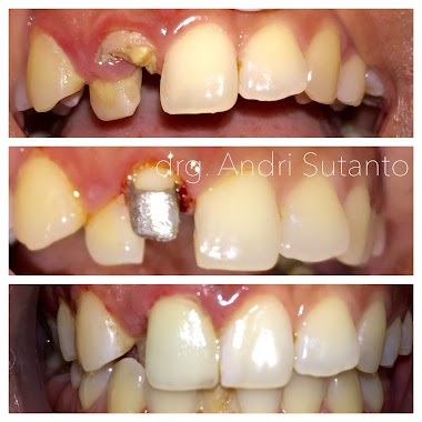 Dentist Andri Sutanto, Author: Dokter Gigi Andri Sutanto