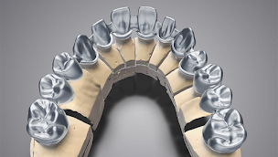 Photo n°2 de Dental solution à Carmaux (Laboratoire dentaire)