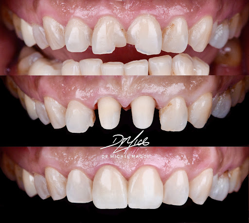 عيادة إنفنتي لطب وتجميل الأسنان ( د. محمد سمير أحمد) - صورة 4