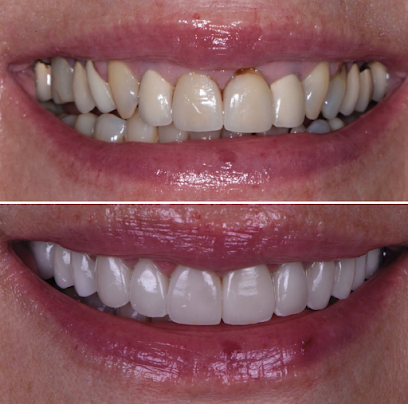 Las Vegas Aesthetic Dentistry