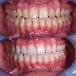 Photo n°15 de Dr Soubane Hafid, Spécialiste en Esthétique du Sourire et en Implantologie dentaire à Istres (Dentiste)