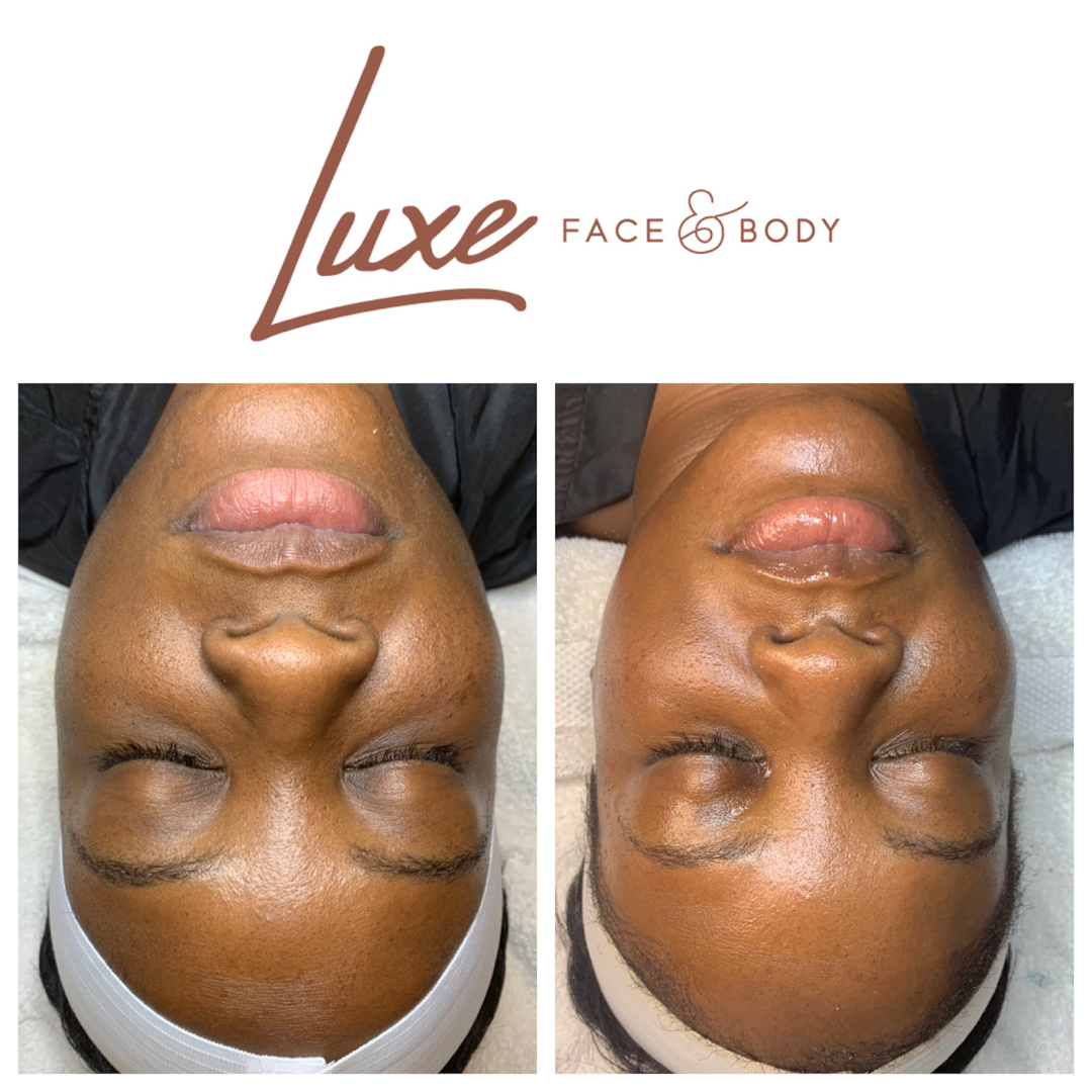 Luxe Face and Body Med Spa photo 43