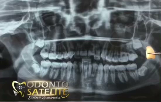 Horarios de odontosatelite