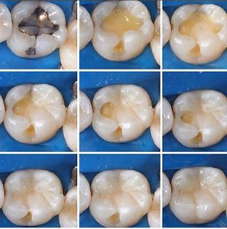 Odontología Naper, Author: natalia pereira