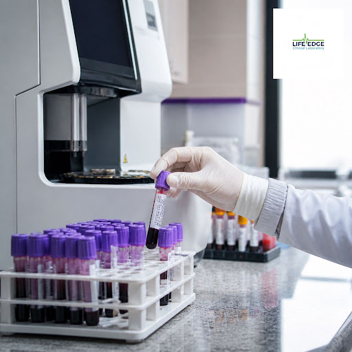 Living with diabetes, thyroid issues, heart disease or kidney problems? Regular lab tests are the… post image