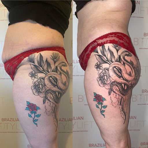 Body Contour Club North West - Thumbnail