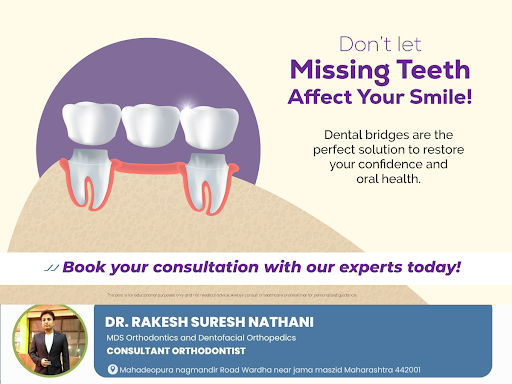 Dental bridges offer a reliable solution for replacing missing teeth, enhancing both appearance a… post image