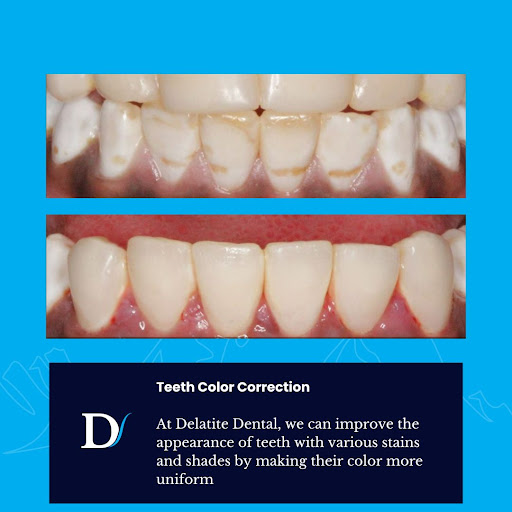 Delatite Dental Mansfield - Thumbnail