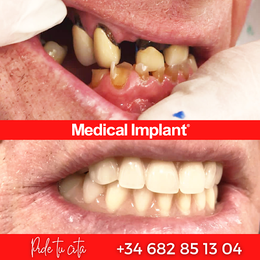 Medical Dental Implant Clinic Tenerife