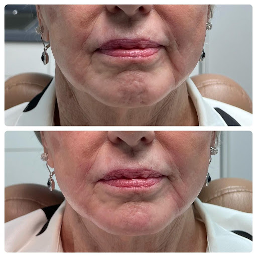 Finger and Associates Plastic Surgery Center