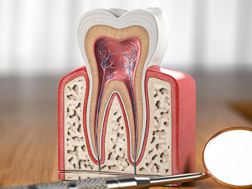 Root Canal Treatments Clinic post image