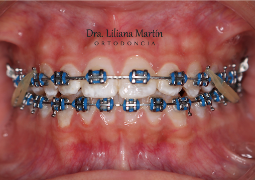 Dra Liliana Martín - Ortodoncia y Odontología general - Thumbnail
