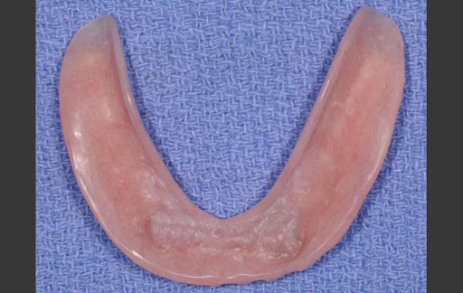 DentKits