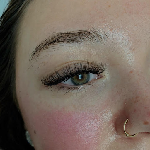 Chelsae Anne Aesthetics - Thumbnail