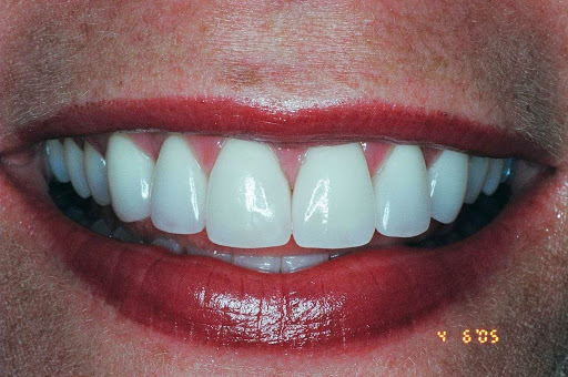 West LKN Dentistry, P.A. - Dental Implants Denver NC - Thumbnail