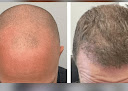 Hair transplant clinic Regency Hair Restoration in Barrington