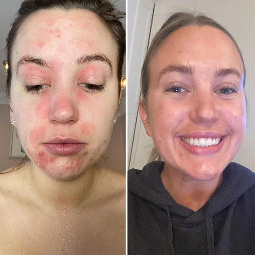 All About Skin Studio Ltd - Thumbnail