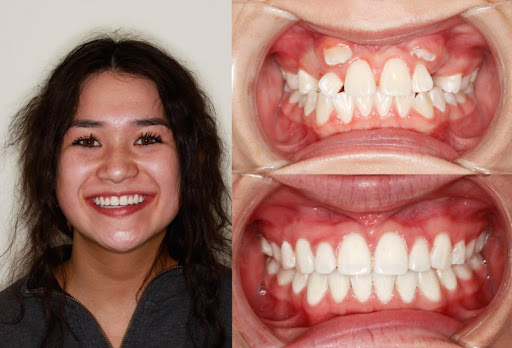 Silcox Orthodontics