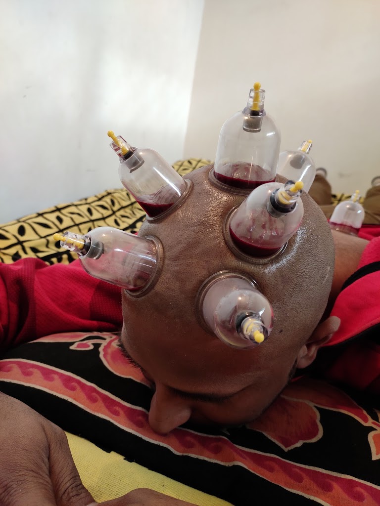 Roorkee Hijama Center