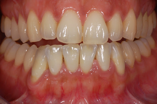 Dr BISSON Bertrand - Dentiste - Metz