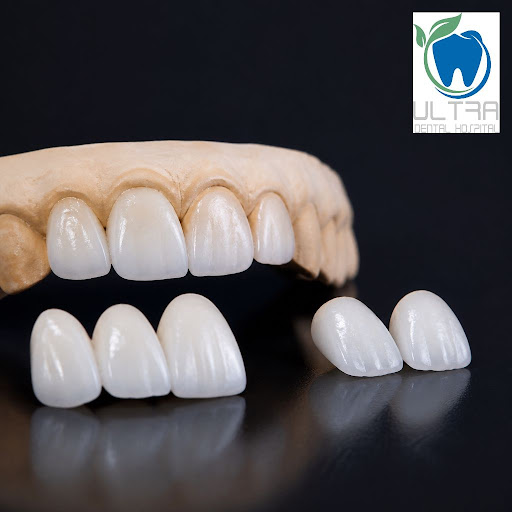 Dreaming of a flawless, confident smile? At Ultra Dental hospital and implant center in Masab Tan… post image