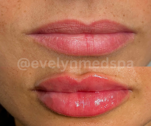 Evelyn Med Spa - Thumbnail