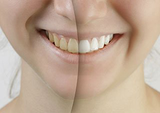 Saratoga Family Dentistry