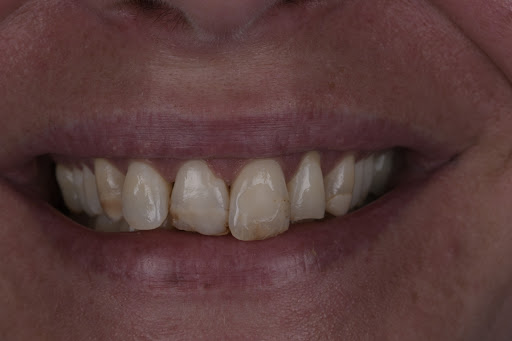 Dental Tiberinus