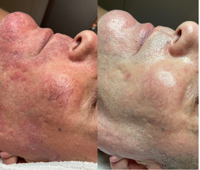 Beautyculture By Janine - Fillers, Profhilo & Hudvård Uppsala