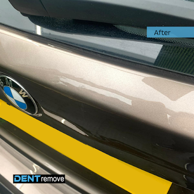 Dent Remove