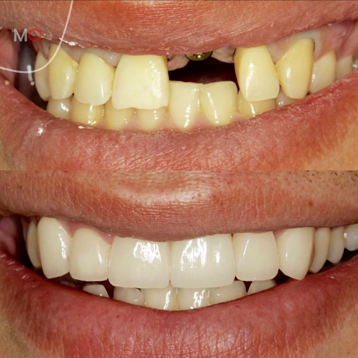Makeover Dental Studio Tijuana - Thumbnail