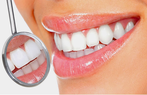 Chianese Dr.ssa Maria - Studio Dentistico Catanzaro Lido - Thumbnail