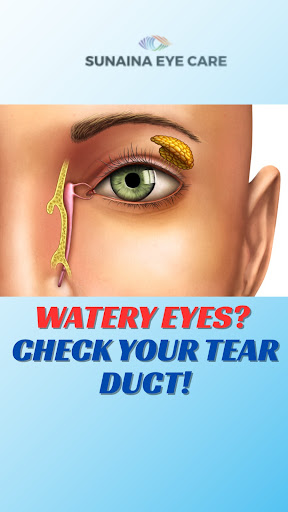 *💧 Watery Eyes? It Might Be a Blocked Tear Duct! 👁️* post image