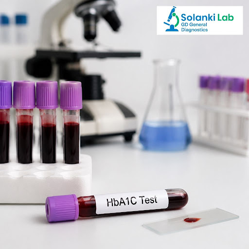 Managing diabetes is not just about daily sugar checks. HbA1C testing shows your average blood su… post image
