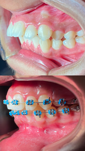 Consultorio Dental “Pro” Dra. Yoselin Bandala - Thumbnail