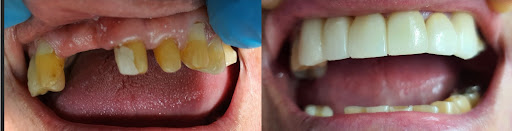 Odontotab - Visual