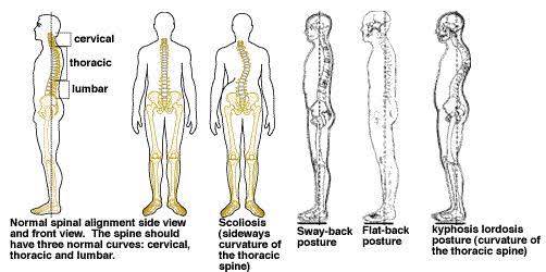 Pain And Posture Physiotherapy Clinic, Author: iman fisio