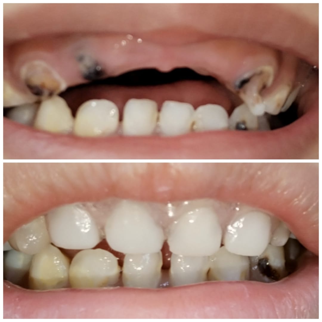 ابن سينا لطب الأسنان والجلدية والليزر الدمام - فرع المزروعية - صورة 3