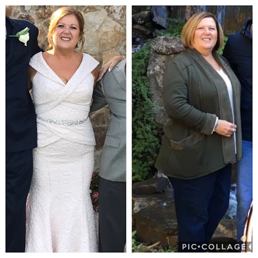Advanced Skin & Weight Loss - Thumbnail