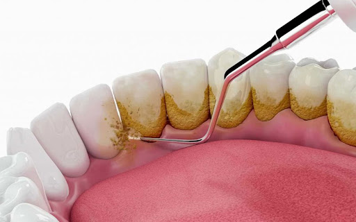 Fresh beginnings in oral health start with a clinic that understands comfort, precision, and trus… post image