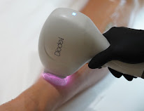 Centre Laser Victor Hugo Nice à Nice