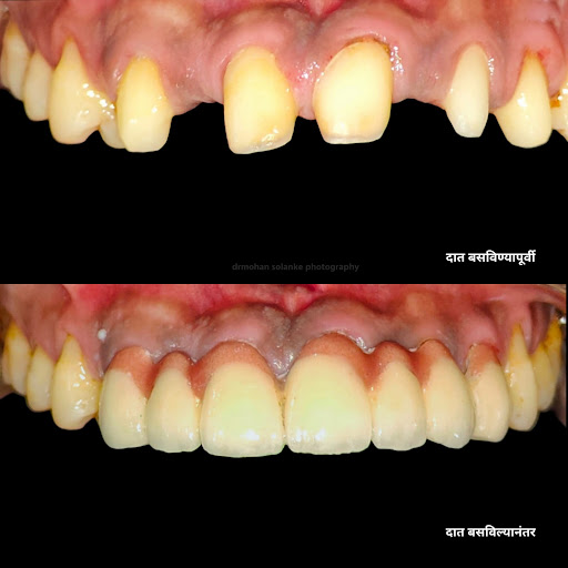 #DentalBridge post image