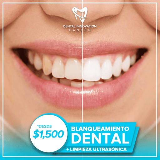 Dental Innovation Cancún - Tu Dentista en Cancún - Thumbnail
