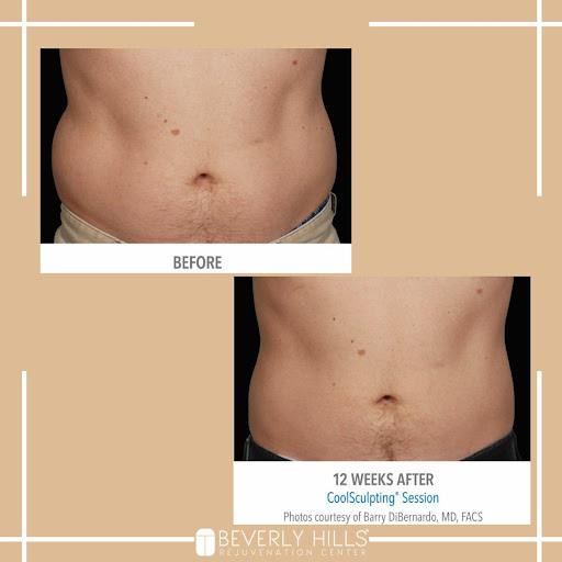 Beverly Hills Rejuvenation Center - Alliance - Thumbnail