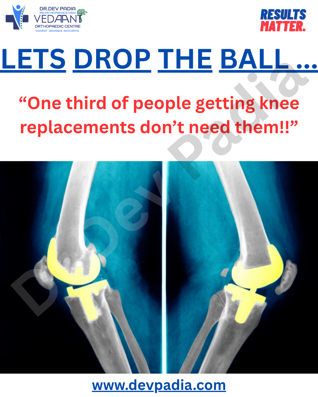 A knee replacement is a decidedly unpleasant event